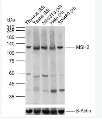 Anti-MSH2 antibody-错配修复蛋白2抗体