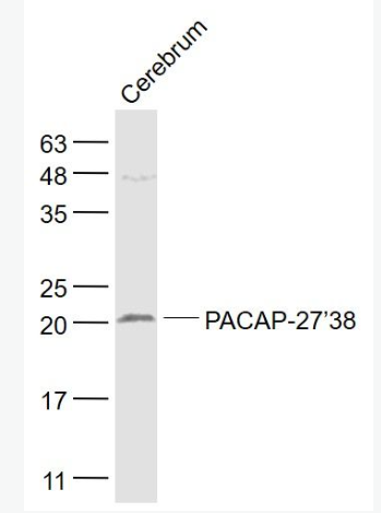 Anti-PACAP-27/38 antibody-腺苷酸环化酶激活肽-27/38抗体