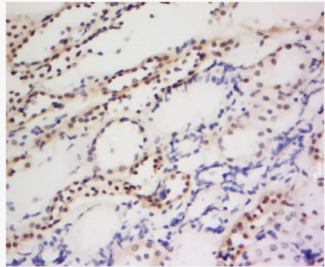 Anti-PIWIL1 antibody-piwi样1蛋白抗体