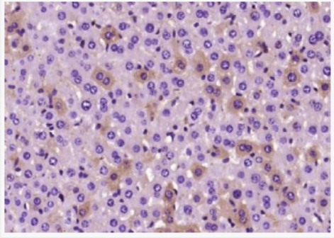 Anti-presenilin 1 antibody-早老素蛋白-1抗体