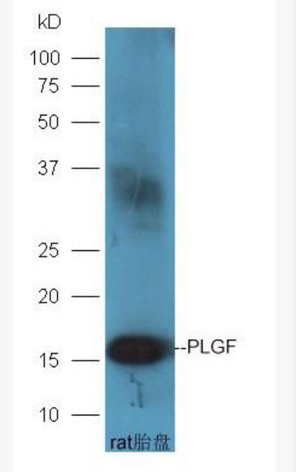 Anti-PLGF antibody-胎盘生长因子抗体