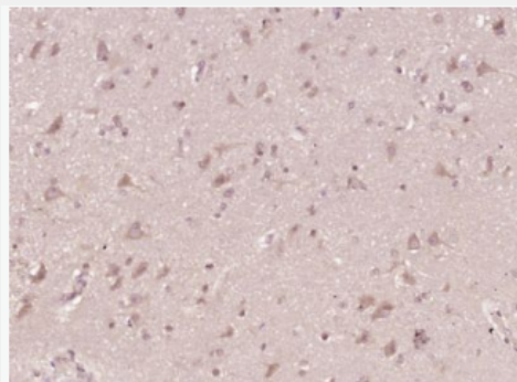 Anti-Phospho-Ret (Tyr905) antibody-磷酸化RET原癌基因抗体