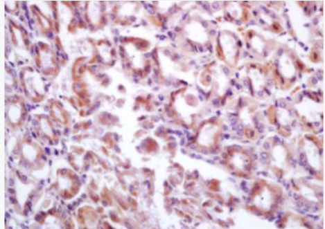 Anti-DMBT1 antibody-抑癌基因抗体