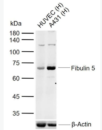 Anti-Fibulin 5 antibody-衰老关键蛋白抗体