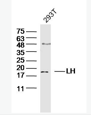 Anti-LHB antibody-促黄体素β亚单位抗体