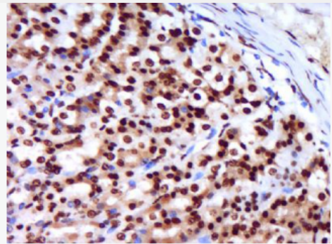 Anti-CCL3  antibody-巨噬细胞炎症因子1α抗体