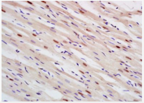 Anti-CSF1 antibody-巨噬细胞克隆刺激因子抗体