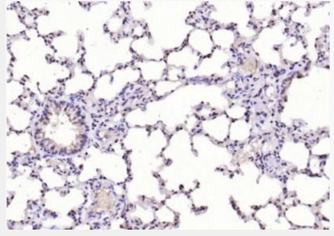 Anti-SHBG antibody-性激素结合球蛋白抗体