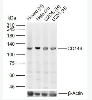 Anti-CD146 antibody-黑色素瘤细胞粘附分子CD146抗体