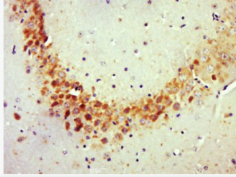 Anti-Rho C antibody-RhoC抗体