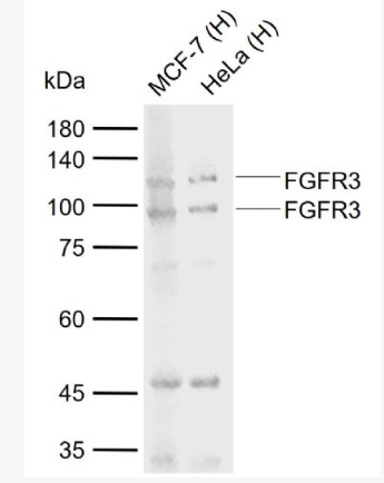 Anti-FGFR3 antibody-成纤维细胞生长因子受体3抗体