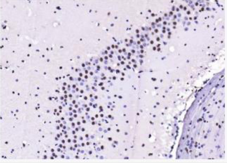 Anti-Cardiac Troponin I/TNNC1 antibody-心肌肌钙蛋白抗体