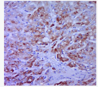 Anti-CCL20 antibody-巨噬细胞炎性蛋白MIP-3a抗体