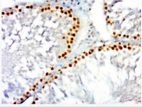 Anti-TNF alpha(1F6) antibody-肿瘤坏死因子-α单克隆抗体