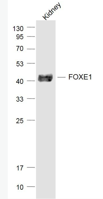 Anti-FOXE1 antibody-甲状腺转录因子-2抗体