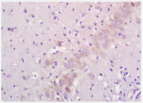 Anti-5-HTR2B antibody-5-羟色胺受体2B抗体