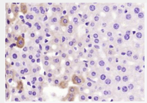 Anti-Thrombin heavy chain antibody-凝血酶(凝血因子II)重链抗体