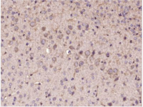 Anti-NGB antibody-脑红蛋白/神经血红蛋白/神经球蛋白抗体