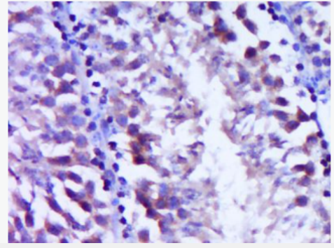 Anti-Vitronectin antibody-玻璃粘连蛋白抗体