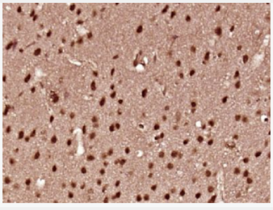 Anti-IL-16 antibody-白介素16抗体