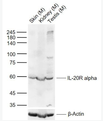 Anti-IL-20R alpha antibody-白介素20受体α链抗体