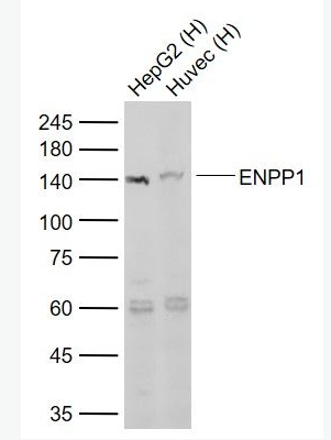 Anti-ENPP1 antibody-核苷酸内焦磷酸酶/磷酸二酯酶1抗体