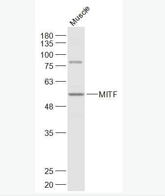 Anti-MITF antibody-微小细胞血症相关转录因子抗体