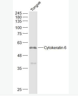 Anti-Cytokeratin 6 antibody-细胞角蛋白6抗体