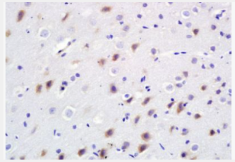 Anti-BDKRB2 antibody-缓激肽B2受体抗体