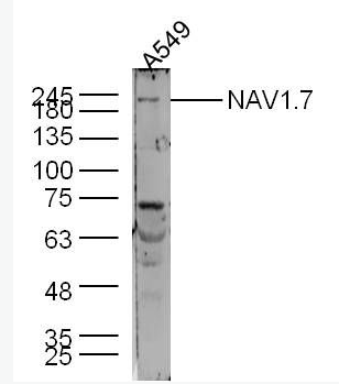 Anti-NAV1.7 antibody-电压开启的钠离子通道SCN9A抗体