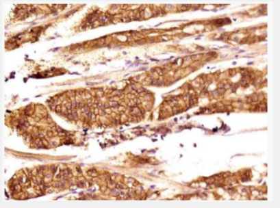 Anti-TEM1 antibody-内涎蛋白/内皮唾液酸蛋白抗体