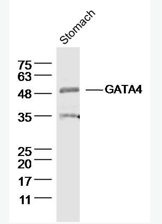 Anti-GATA4  antibody-GATA结合蛋白4抗体