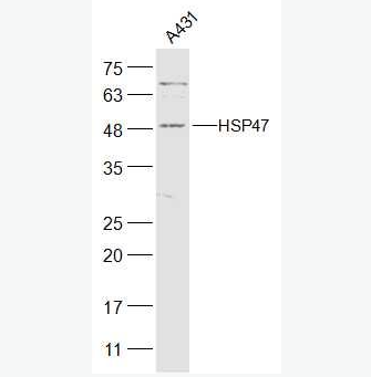 Anti-HSP47 antibody-热休克蛋白-47抗体