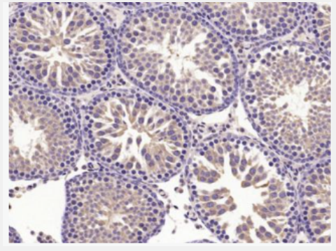 Anti-DNAJC3 antibody-干扰素诱导蛋白p58ipk抗体