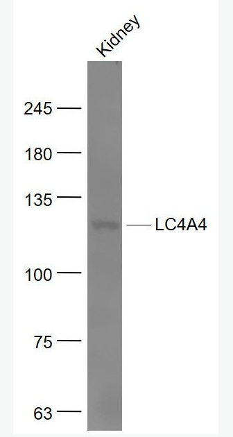 Anti-SLC4A4antibody-碳酸氢钠协同转运蛋白4-A4抗体