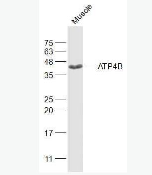 Anti-ATP4B antibody-氢钾ATP酶通道蛋白抗体