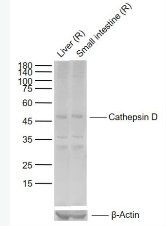 Anti-Cathepsin D antibody-组织蛋白酶D轻链抗体