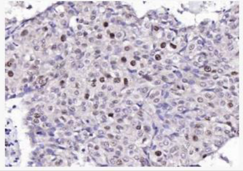 Anti-TFRC antibody-转铁蛋白受体（CD71）抗体