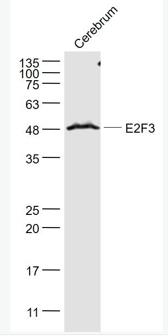 Anti-E2F3 antibody-转录因子E2F-3抗体