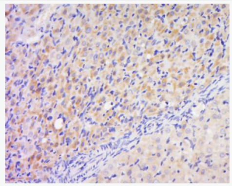 Anti-phospho-PAK2 (Ser141) antibody-磷酸化p21激活激酶2抗体