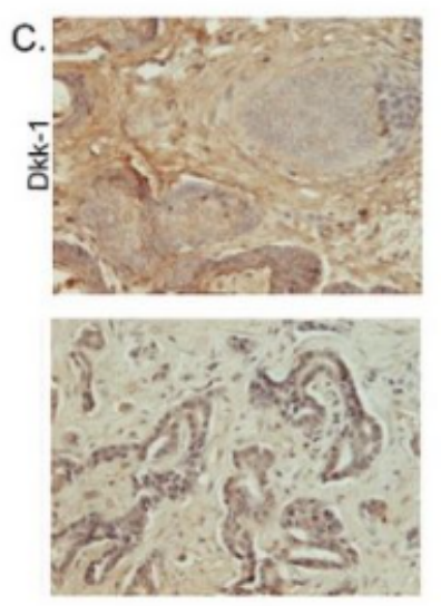 Anti-DKK1 antibody-抑癌蛋白DKK1抗体