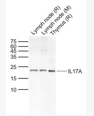 Anti-IL17A antibody-白介素-17抗体