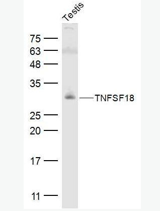 Anti-TNFSF18 antibody-肿瘤坏死因子配体超家族成员18抗体