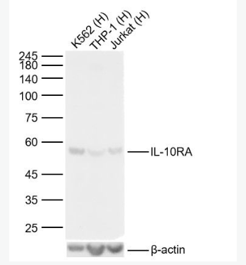 Anti-IL-10RA antibody-白细胞介素-10受体a抗体
