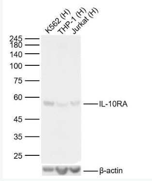 Anti-IL-10RA antibody-白细胞介素-10受体a抗体.