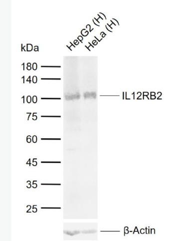 Anti-IL12RB2 antibody-白细胞介素-12受体β2抗体