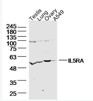 Anti-IL5RA antibody-白介素-5受体α链抗体IL-5Rα