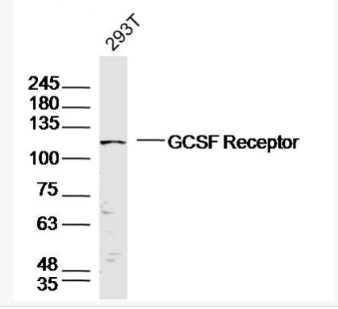 Anti-GCSF Receptor antibody-粒细胞-巨噬细胞集落刺激因子3受体抗体