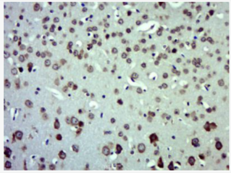 Anti-CXCL11 antibody-干扰素诱导T细胞趋化因子抗体