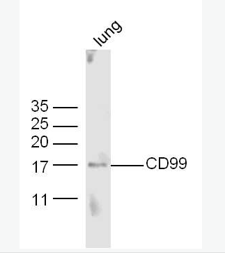 Anti-CD99 antibody-CD99抗体